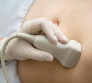 na-kakix-srokax-delayut-uzi-pri-beremennosti-2