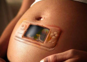 na-kakix-srokax-delayut-uzi-pri-beremennosti-6