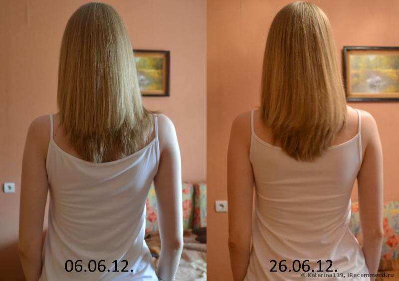 никотиновая кислота для роста волос фото