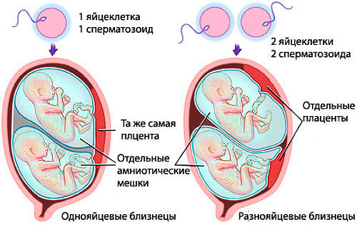 ультразвуковое исследование для выявления многоплодия