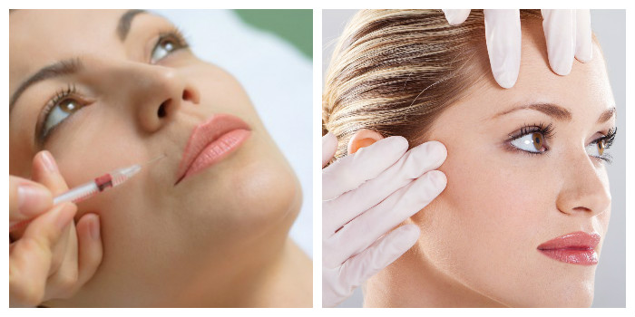 Инъекции ботокса